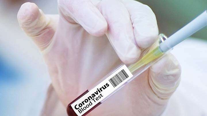 Количество заразившихся коронавирусом продолжает бить рекорды Фото №1